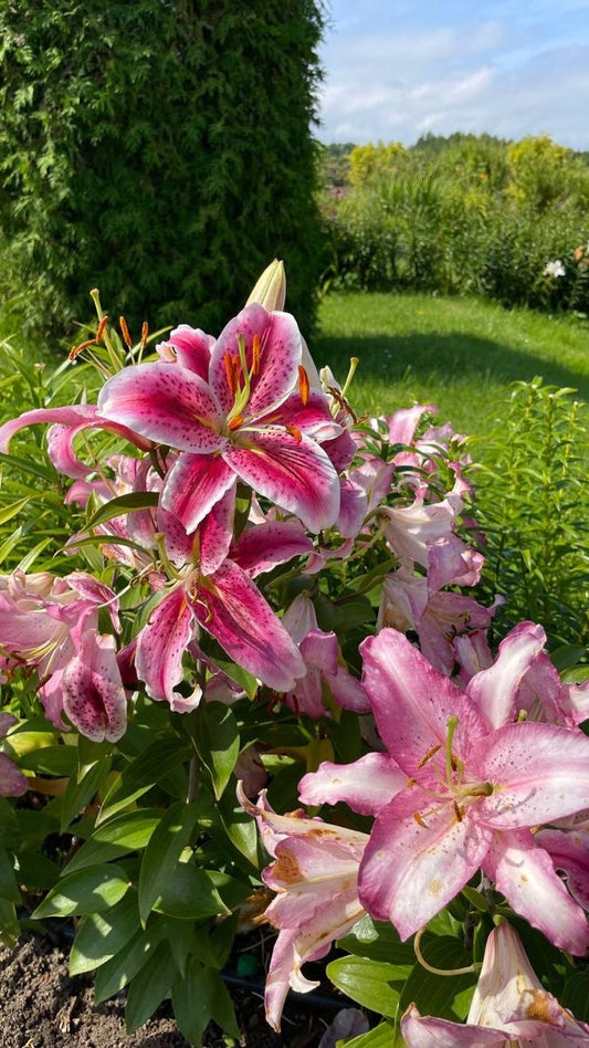 Imported Oriental Lily Flower Bulbs Size 16/18 – Premium Large Bulbs | Pack of 5 & 10